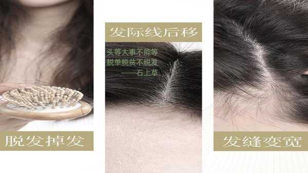 怎么让头发长的多点（头发毛囊里只有一根头发还挺细头发显少怎么能让头发变多点阿）