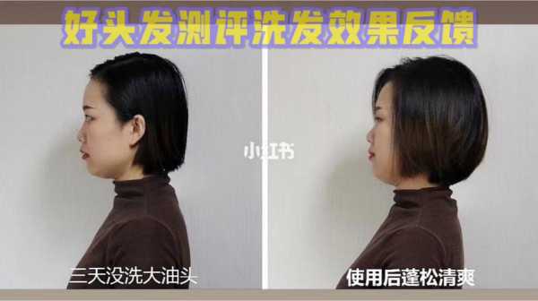 头发出油严重怎么改善,头发超级油怎么办用什么洗发水