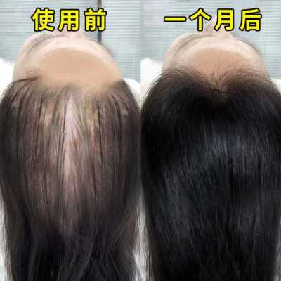 怎么才能让头发变密（怎么才能让头发变密一点）