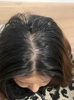 9个月宝宝头顶头发稀少怎么办给宝宝吃什么补,学生头发少怎么办变多