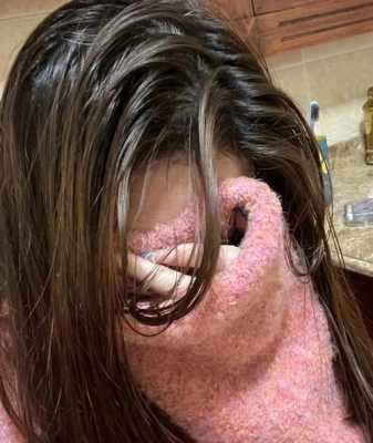 11岁男孩头发出油怎么回事,小孩头发油腻怎么回事啊