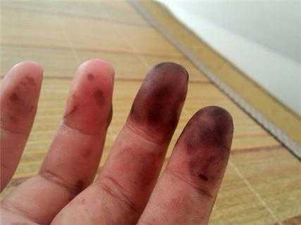 手上有染发剂怎么去除,染发剂弄到手上怎么搞