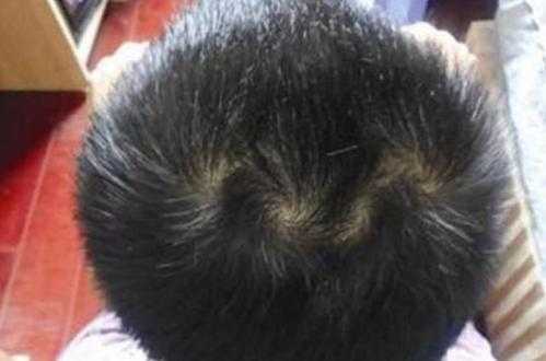 头旋偏右适合什么发型（什么时辰头旋偏右）