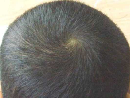 头旋偏右适合什么发型（什么时辰头旋偏右）