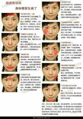 下巴长痘是怎么引起的（下巴左边长痘是什么原因）