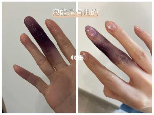 染头发手上色怎么办（在家染发手变色了怎么办）