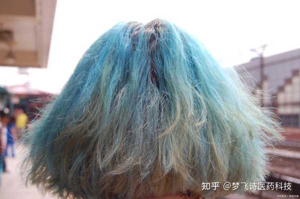 染发掉发严重怎么办（染发掉发严重怎么办还能长不）