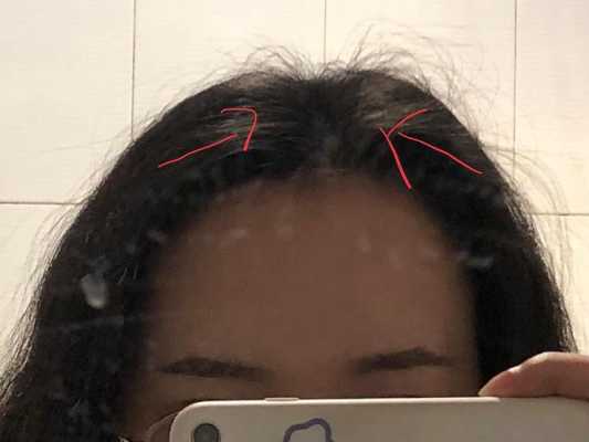 头上头发少怎么办（头发不顺，就是有很多杂毛翘着，而且发量少，可以做软化吗，或者说应该怎么打理）
