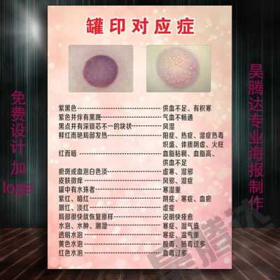 脸部皮肤堵塞怎么办（面部罐印怎么快速消除）