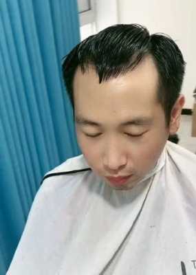 鬓角两边秃怎么拯救,秃鬓角怎么能长头发呢