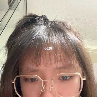 刘海剪毁了有什么办法快速长出来,刘海剪坏了怎么长的快一点