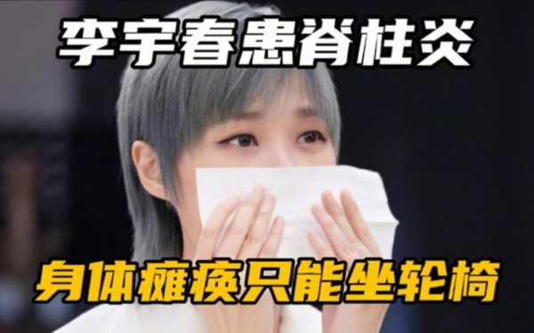 李宇春什么来头,李宇春什么时候得的强直性脊柱炎
