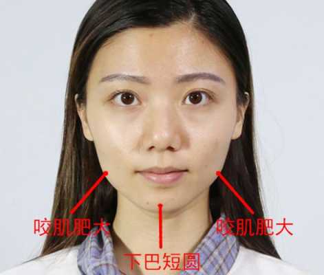 咬肌大是什么脸型,大圆脸什么样