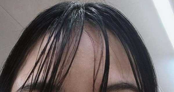 怎么快速去除刘海的油（跑完操刘海油了怎么办）