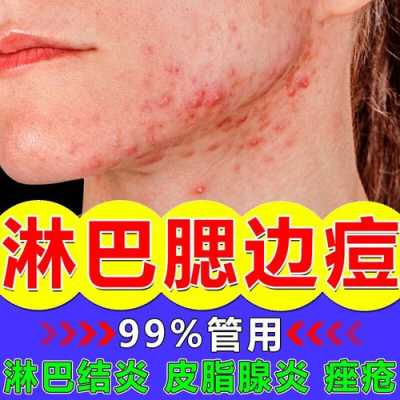 什么去痘好（痘痘怎么去除效果好）