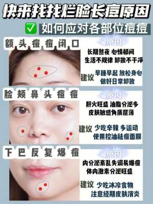 额头痘痘什么原因（额头痘痘什么原因引起的）