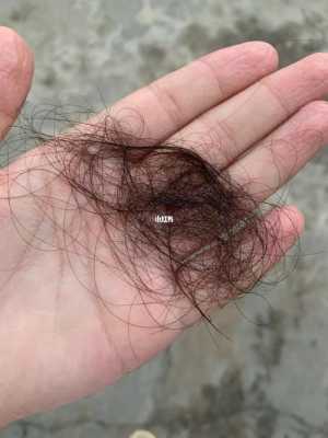 3天洗一次头掉头发50根正常吗,洗头发掉怎么办小妙招