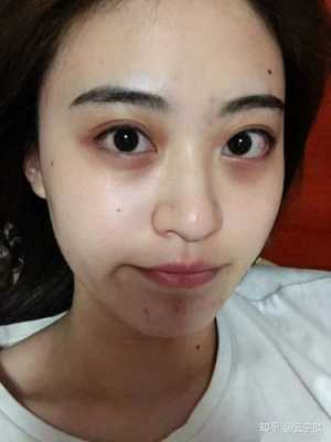 眼卷发黑是怎么回事（眼卷发黑是怎么回事啊）
