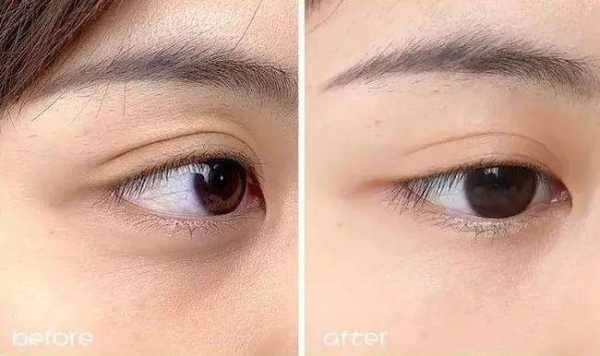 眼卷发黑是怎么回事（眼卷发黑是怎么回事啊）