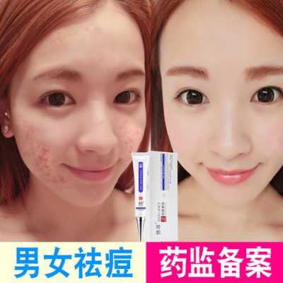 怎么才能有效去痘印（去痘印有什么好方法）