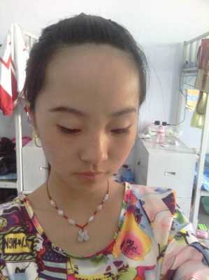 什么叫额头高,突额头是什么原因造成的