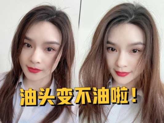 我是油性头发怎么办（油性头发怎么改善肤质）