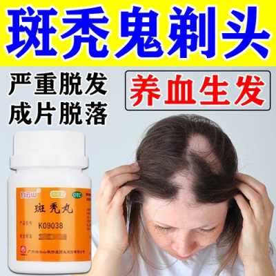 什么治疗头发（什么治疗头发稀少）