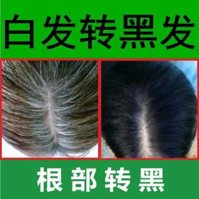 什么治疗头发（什么治疗头发稀少）