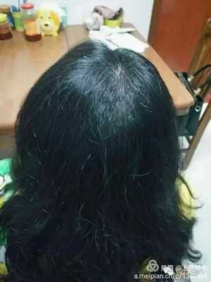 为什么头发很黑（为什么别人说我的头发很粗又很黑）