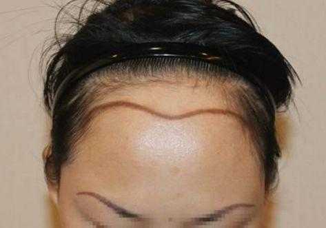 发际线要到哪里才算高,怎么样的发际线才算高女生