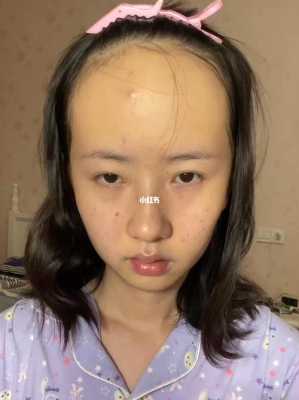 发际线要到哪里才算高,怎么样的发际线才算高女生