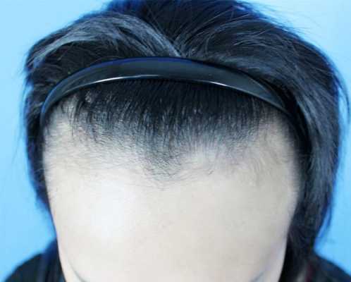 发尖是什么了（发尖是什么意思）